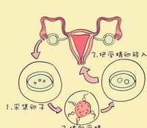 死精率80%的男性可以在吉安市做三代试管吗？公开2026做三代试管条件