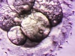 俄罗斯试管全过程是怎么样的？附俄罗斯试管婴儿流程分享